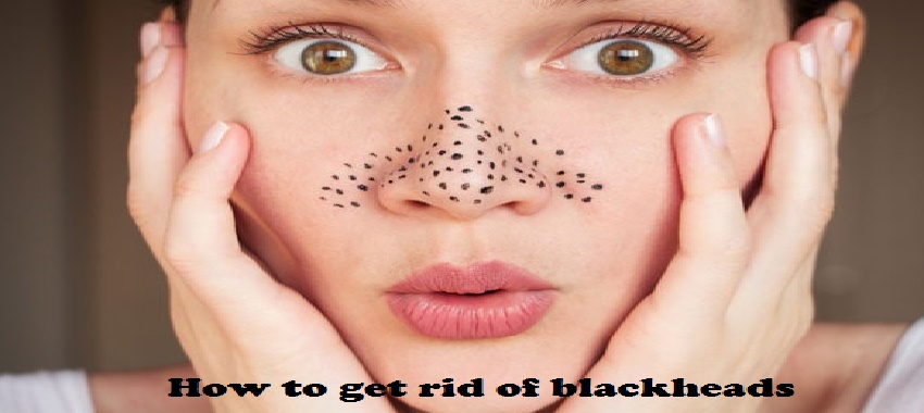how to get rid of blackheads tips